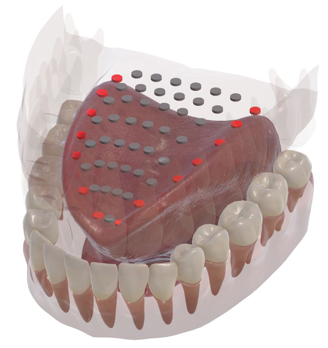 3D Electropalatography with electrodes