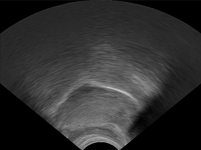 Ultrasound tongue imaging /a/