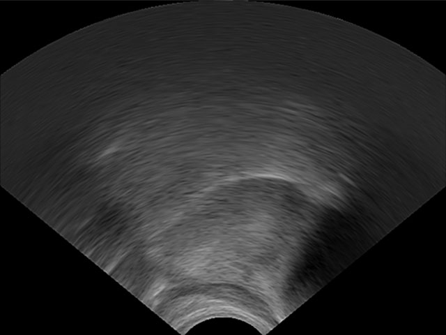 Ultrasound tongue imaging /d/