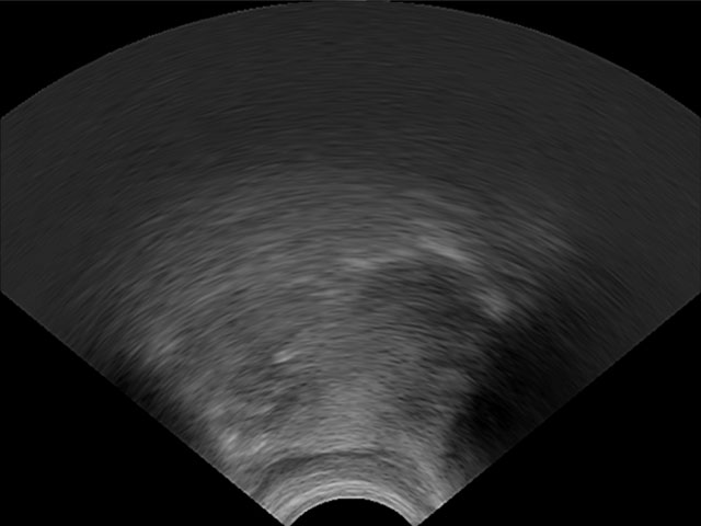 Ultrasound tongue imaging /i/