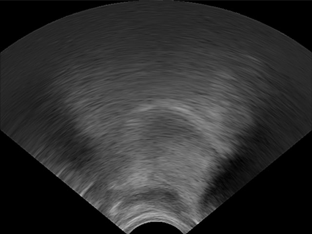 Ultrasound tongue imaging /k/