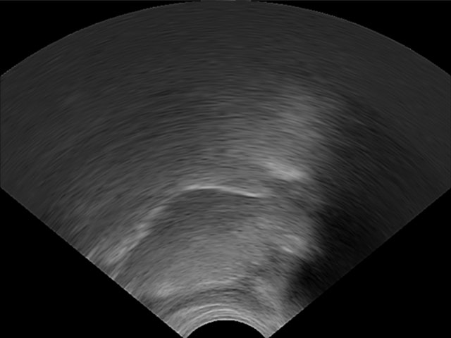 Ultrasound tongue imaging /r/
