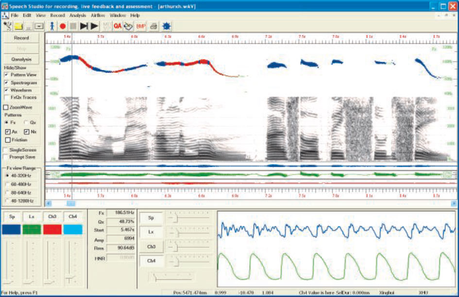 Electroglottography software