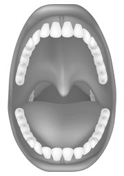 No tongue palate contact