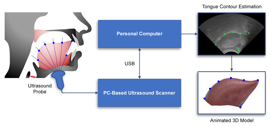 How enhanced ultrasound tongue imaging works