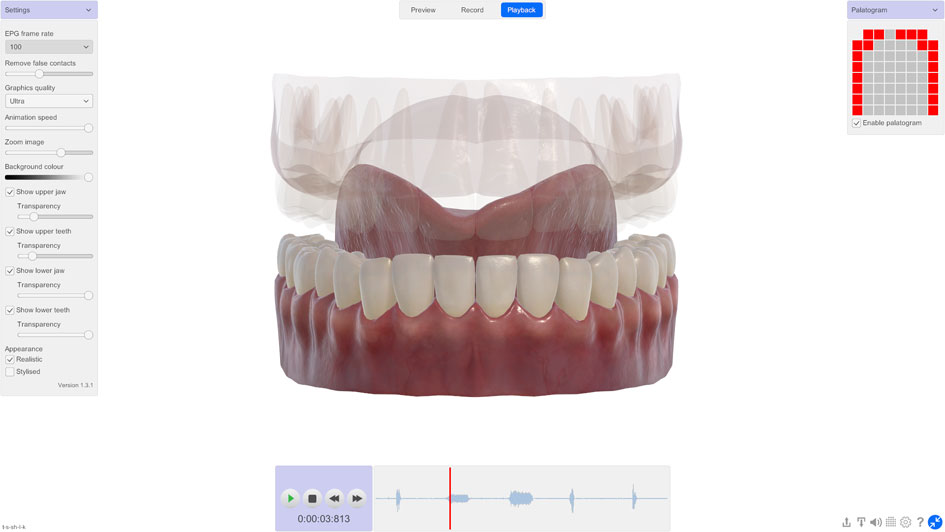 3D Electropalatography software • front view