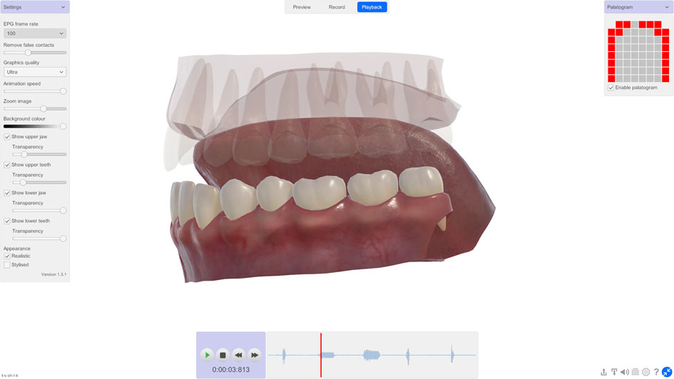 3D Electropalatography software • lateral view