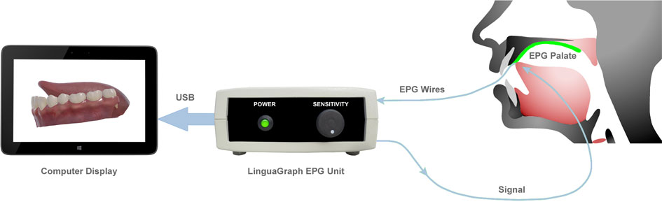 How 3D electropalatography works