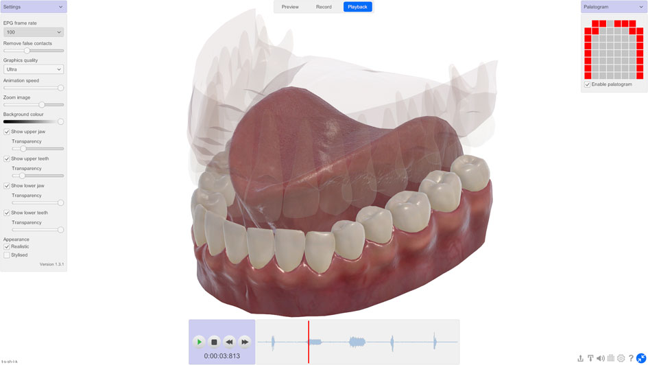 3D Electropalatography software