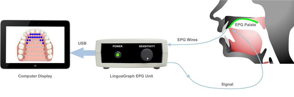 How electropalatography works