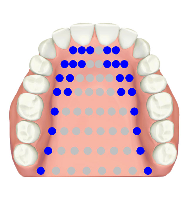 Electropalatography • alveolar grooved /z/, /s