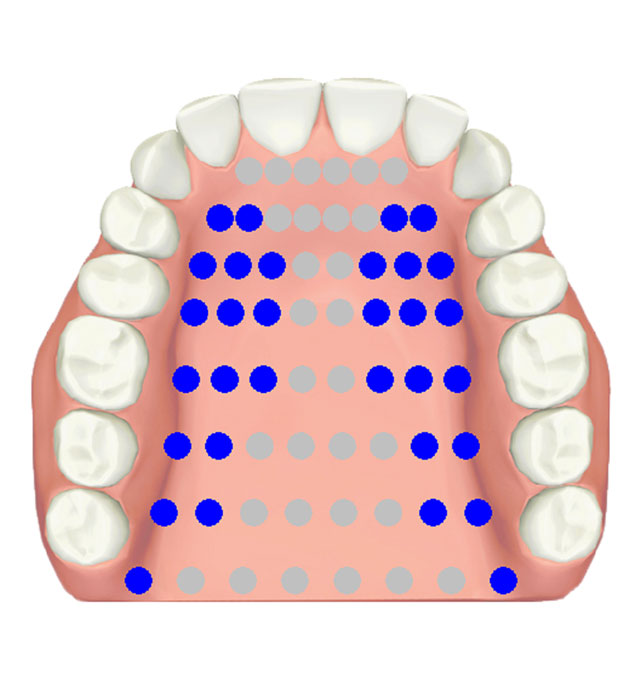 Electropalatography • post-alveolar grooved /ʃ/, /ʒ/
