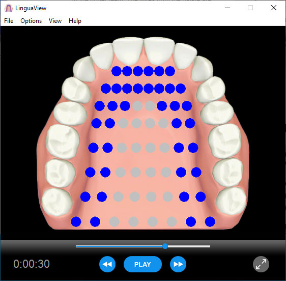 Electropalatography software