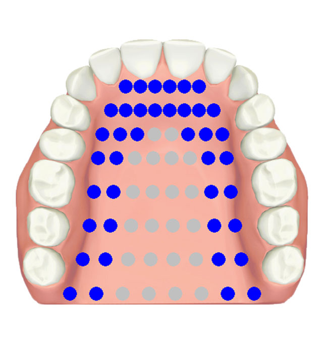 EPG alveolar stop /t/, /d/, /n/