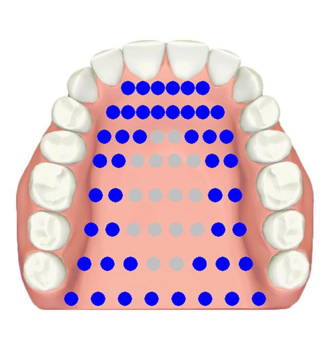 Electropalatography • double alveolar-velar /tk/, /kt/, /kl/