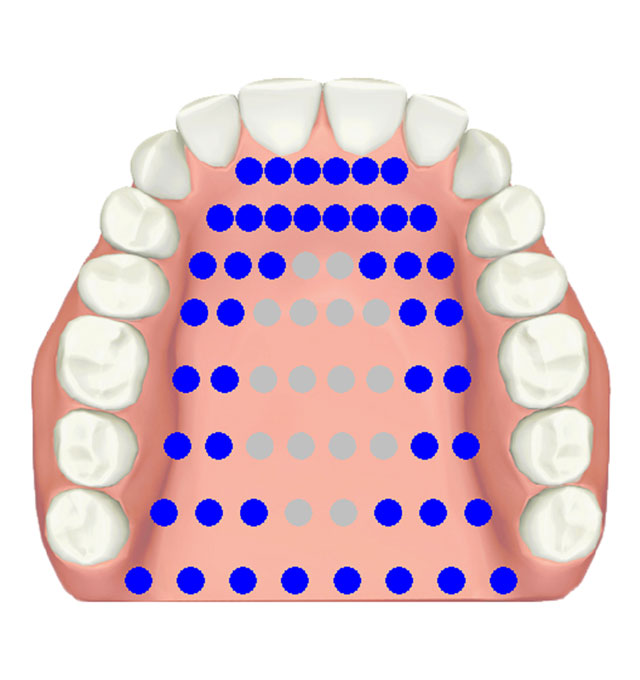 EPG double alveolar-velar /tk/, /kt/, /kl/