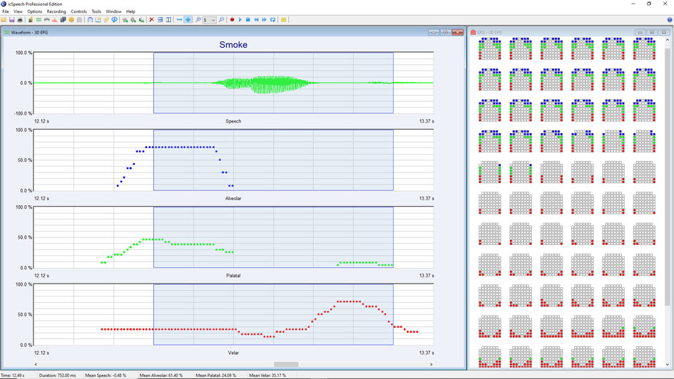 icSpeech Professional Edition • palatographs and lingual waveforms