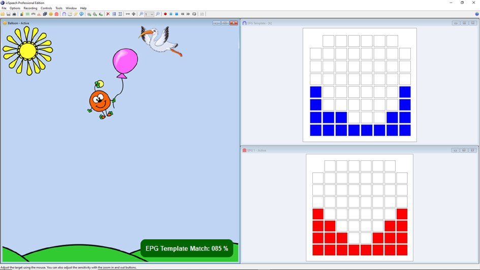 Electropalatography software • electropalatography template matching game