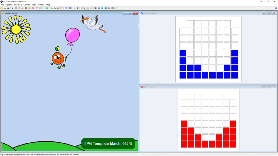icSpeech Professional Edition • electropalatography template matching game