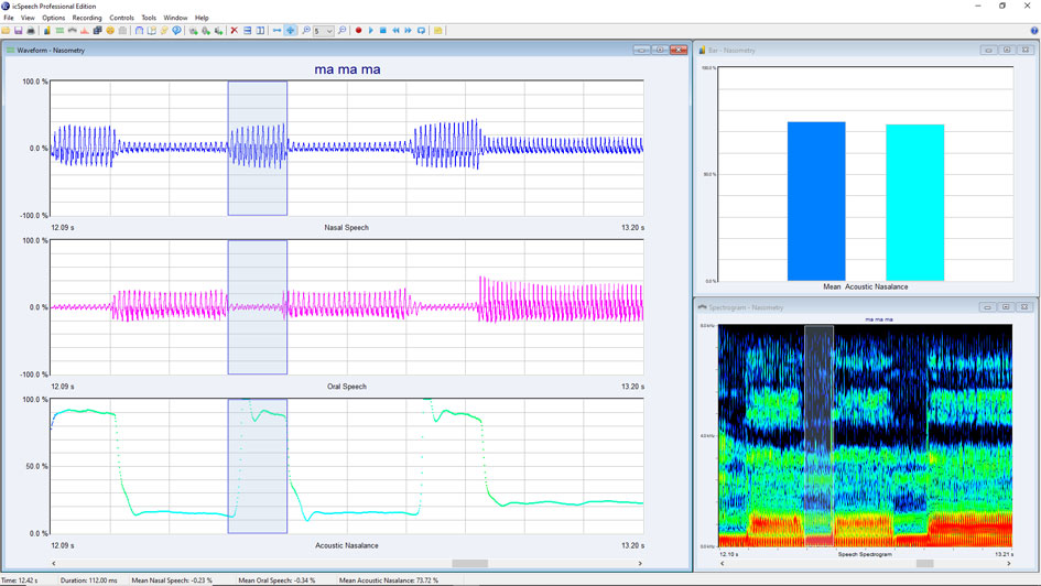 Nasometry software • nasalance, nasal and oral speech waveforms, spectrogram and bar displays