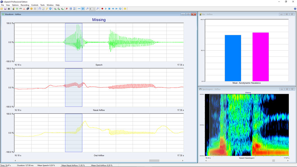 icSpeech Professional Edition • speech, nasal and oral airflow waveforms, spectrogram and bar displays