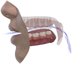 SNORS 3D • oral airflow (soft palate raised)