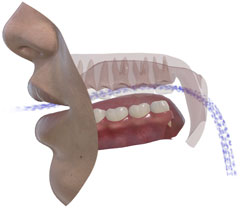 SNORS 3D • voiced airflow (intermittent flow)